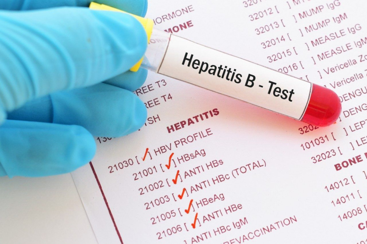 Hepatitis B